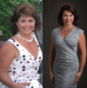 slimming after bio pellet