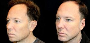rejuvenation after 30