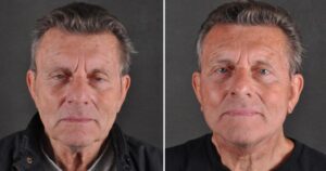 rejuvenation after 50